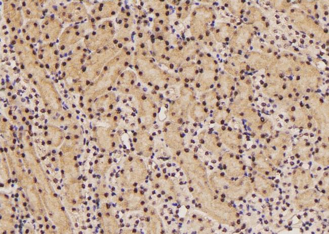 Phospho-eIF2 beta (Tyr298) Antibody in Immunohistochemistry (Paraffin) (IHC (P))