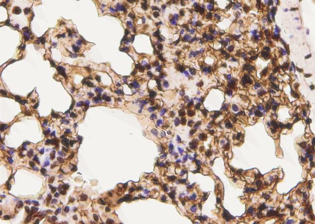 Phospho-ErbB3 (Tyr1222) Antibody in Immunohistochemistry (Paraffin) (IHC (P))