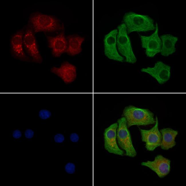 Phospho-FGFR4 (Tyr642) Antibody in Immunocytochemistry (ICC/IF)