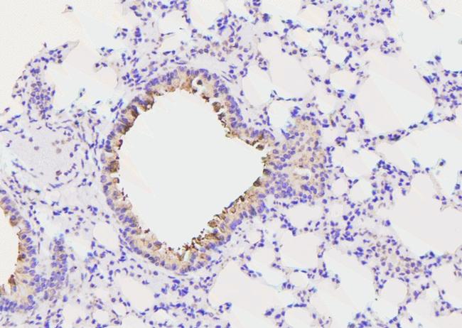 Phospho-c-Cbl (Ser804) Antibody in Immunohistochemistry (Paraffin) (IHC (P))