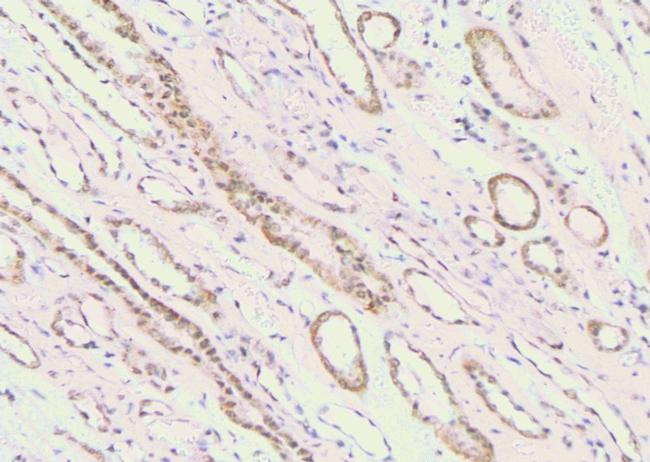 Phospho-c-Cbl (Ser767) Antibody in Immunohistochemistry (Paraffin) (IHC (P))