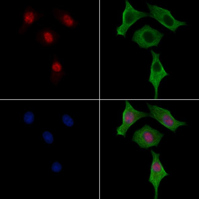 Phospho-GATA3 (Ser369) Antibody in Immunocytochemistry (ICC/IF)