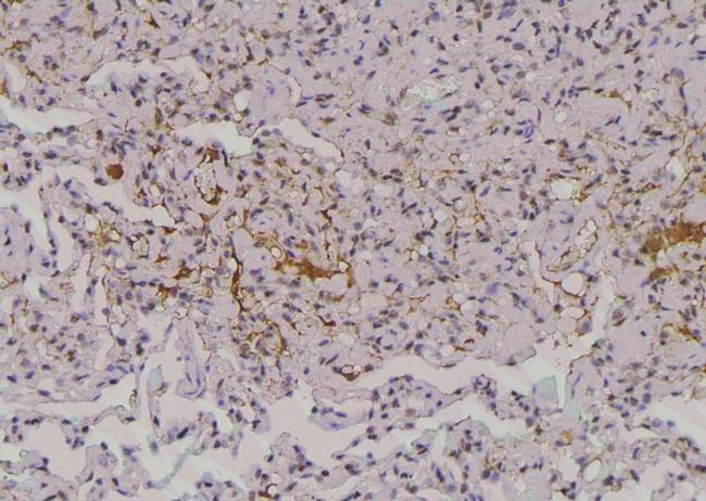 Phospho-EphA2 (Thr587) Antibody in Immunohistochemistry (Paraffin) (IHC (P))