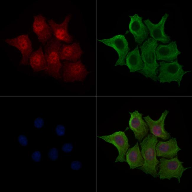 Phospho-NF2 (Ser13) Antibody in Immunocytochemistry (ICC/IF)