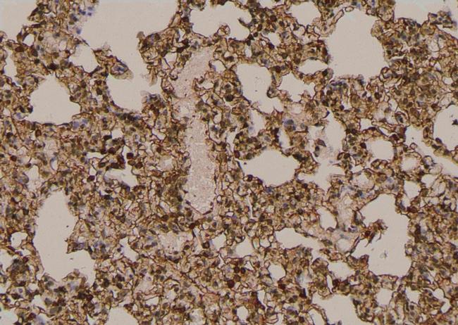 Phospho-MYH9 (Tyr754) Antibody in Immunohistochemistry (Paraffin) (IHC (P))