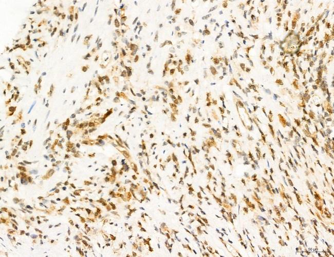 Phospho-FLT3 (Tyr631) Antibody in Immunohistochemistry (Paraffin) (IHC (P))