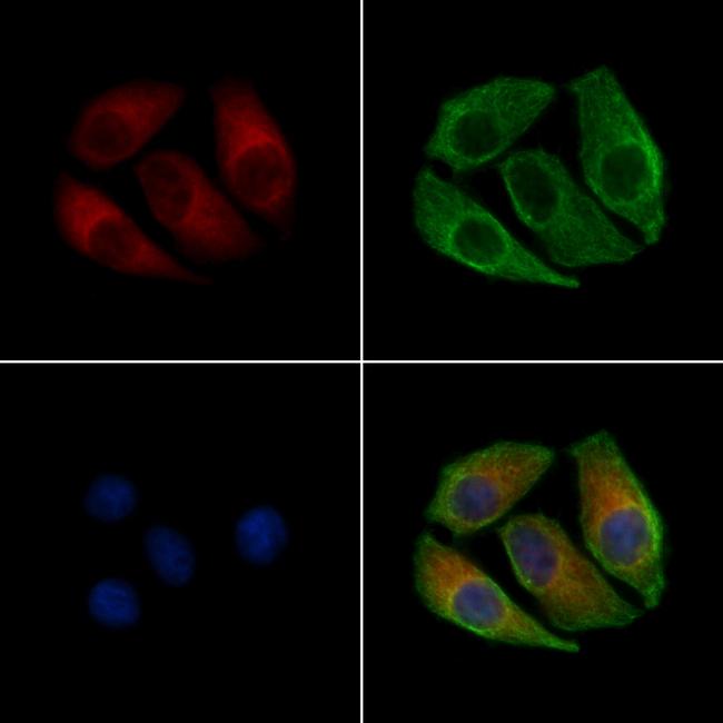 Phospho-GluR1 (Ser836) Antibody in Immunocytochemistry (ICC/IF)