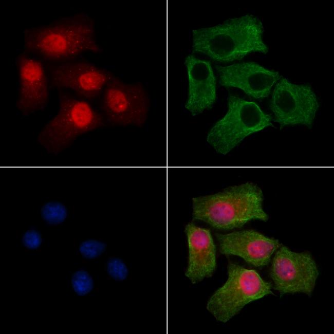 Phospho-mTOR (Ser2454) Antibody in Immunocytochemistry (ICC/IF)