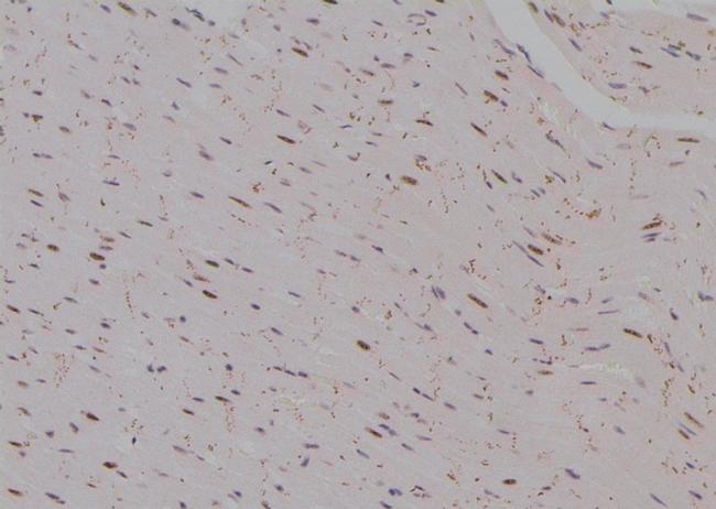 Phospho-TSC2 (Thr938) Antibody in Immunohistochemistry (Paraffin) (IHC (P))