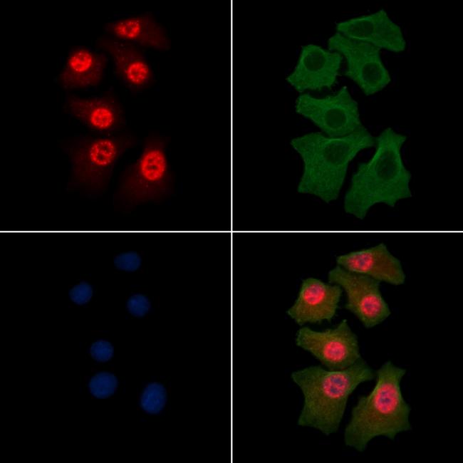 Phospho-CDK7 (Ser164) Antibody in Immunocytochemistry (ICC/IF)