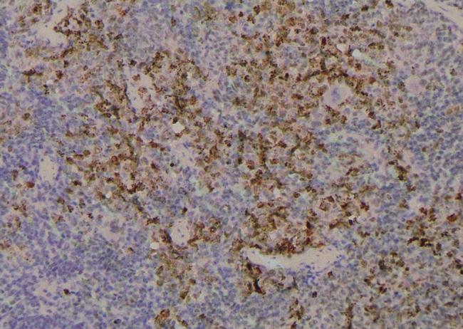 Phospho-CDK9 (Ser347) Antibody in Immunohistochemistry (Paraffin) (IHC (P))