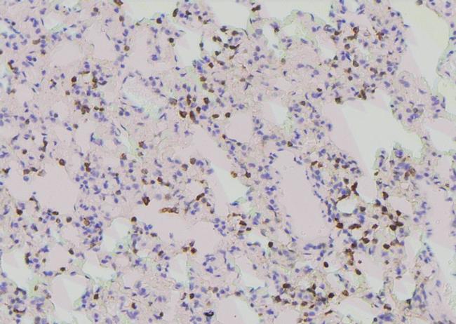 Phospho-PLK1 (Tyr217) Antibody in Immunohistochemistry (Paraffin) (IHC (P))