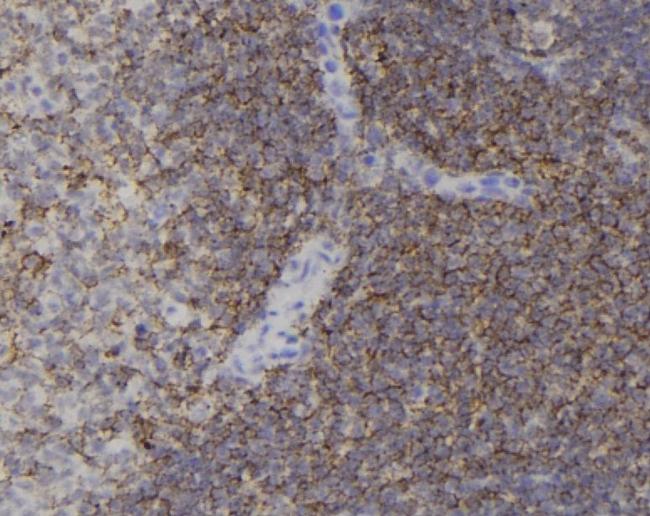 Phospho-Cdc42 (Tyr64) Antibody in Immunohistochemistry (Paraffin) (IHC (P))