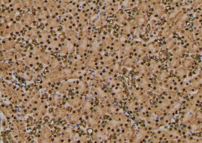 Phospho-RHOA (Thr100) Antibody in Immunohistochemistry (Paraffin) (IHC (P))