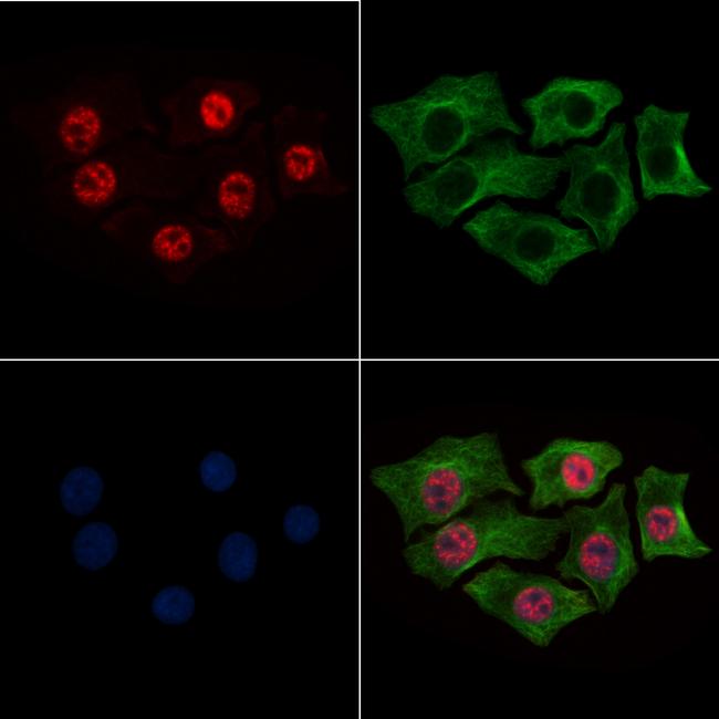 Phospho-CK2 alpha-1 (Tyr360) Antibody in Immunocytochemistry (ICC/IF)