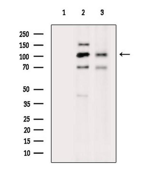 Phospho-PSD-95 (Tyr609) Antibody in Western Blot (WB)