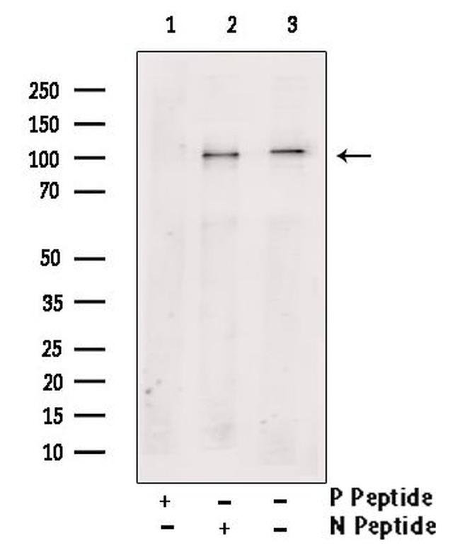 Phospho-PSD-95 (Ser142) Antibody in Western Blot (WB)