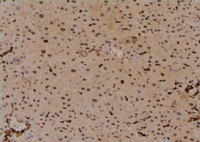 Phospho-PLCB3 (Ser1105) Antibody in Immunohistochemistry (Paraffin) (IHC (P))