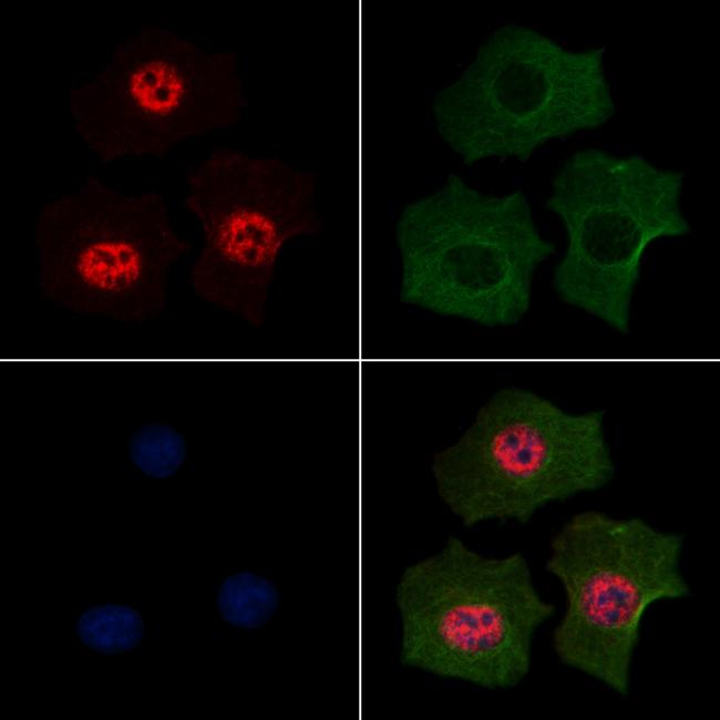 Phospho-MEF2A (Ser479) Antibody in Immunocytochemistry (ICC/IF)