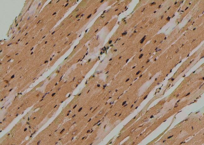 Phospho-TEK (Tyr897) Antibody in Immunohistochemistry (Paraffin) (IHC (P))