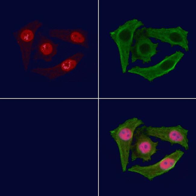 Phospho-MEF2C (Ser396) Antibody in Immunocytochemistry (ICC/IF)