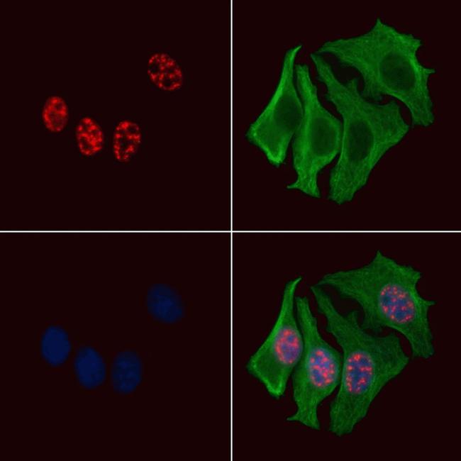 Phospho-MEF2C (Ser459) Antibody in Immunocytochemistry (ICC/IF)