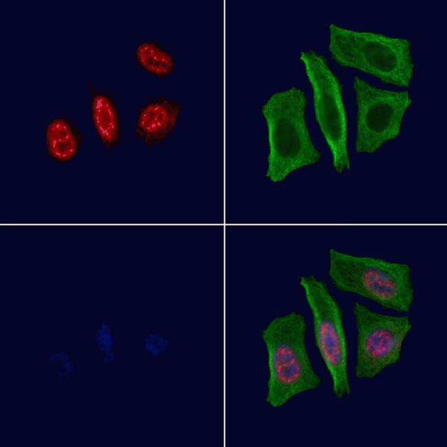 Phospho-FOXM1 (Thr600) Antibody in Immunocytochemistry (ICC/IF)