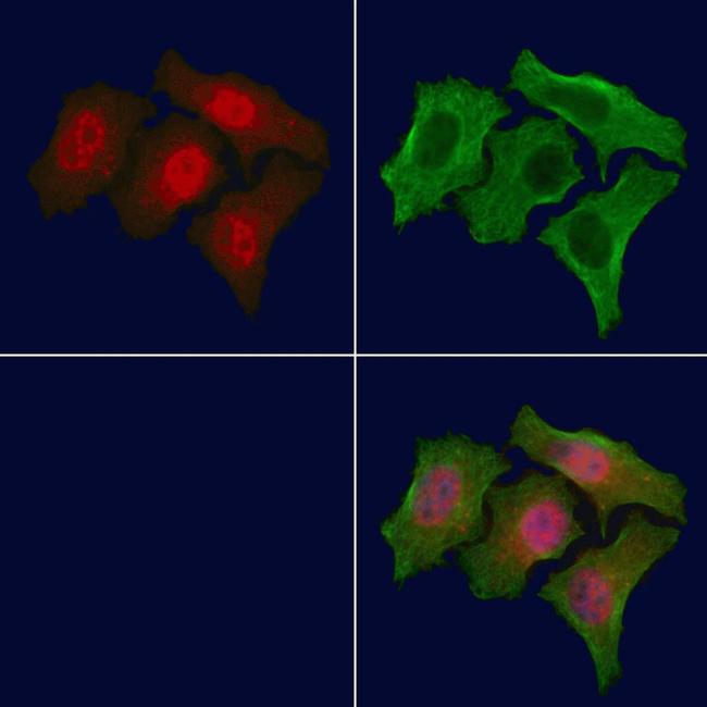 Phospho-Acetyl-CoA Carboxylase (Thr1196) Antibody in Immunocytochemistry (ICC/IF)