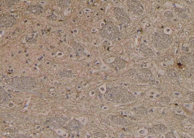 Phospho-NMDAR2B (Ser1478) Antibody in Immunohistochemistry (Paraffin) (IHC (P))