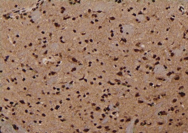 Phospho-NMDAR2B (Ser1303) Antibody in Immunohistochemistry (Paraffin) (IHC (P))