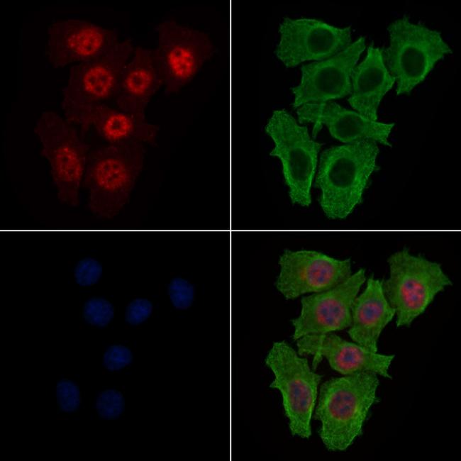 Phospho-SKP2 (Thr417) Antibody in Immunocytochemistry (ICC/IF)