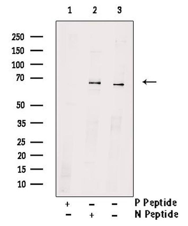 Phospho-SQSTM1 (Ser266) Antibody in Western Blot (WB)