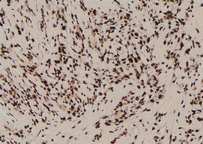 Phospho-PKN2 (Ser815) Antibody in Immunohistochemistry (Paraffin) (IHC (P))