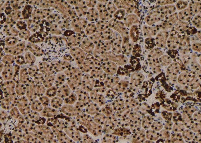 Phospho-VPS34 (Ser244, Ser249) Antibody in Immunohistochemistry (Paraffin) (IHC (P))