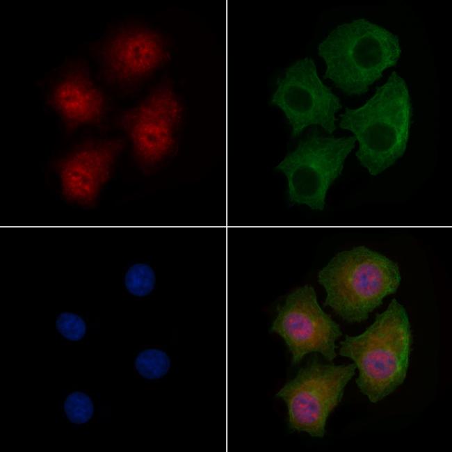 Phospho-SSH3 (Ser9) Antibody in Immunocytochemistry (ICC/IF)