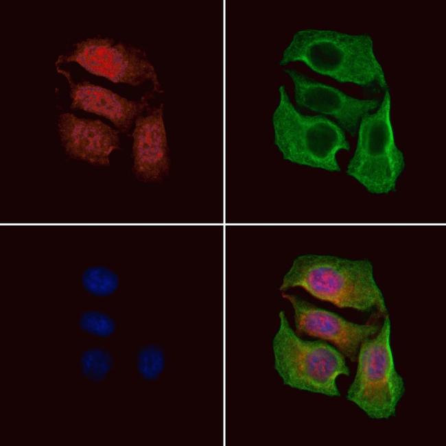 Phospho-GLI1 (Thr1074) Antibody in Immunocytochemistry (ICC/IF)