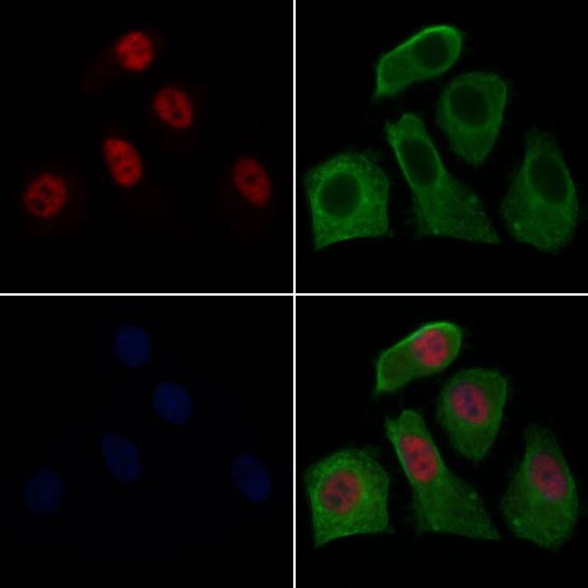 SETD8 Antibody in Immunocytochemistry (ICC/IF)