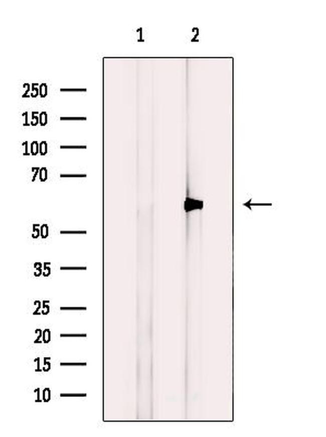 OXSR1 Antibody in Western Blot (WB)