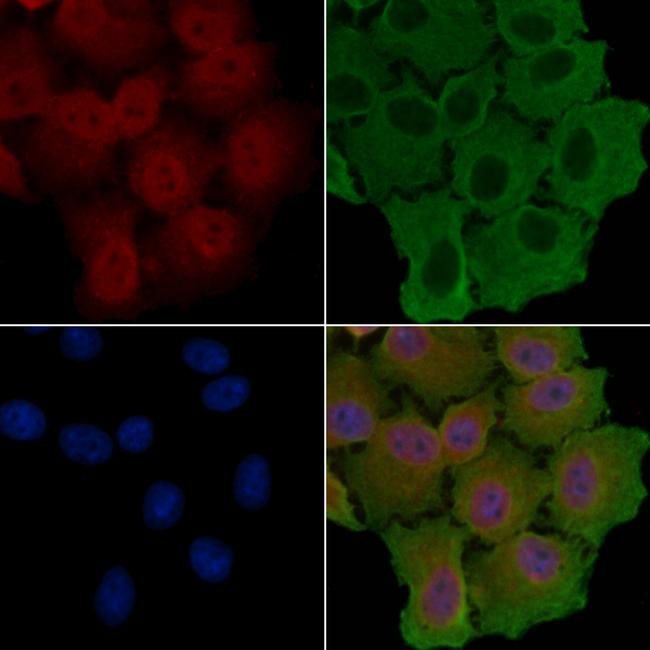 HCK Antibody in Immunocytochemistry (ICC/IF)