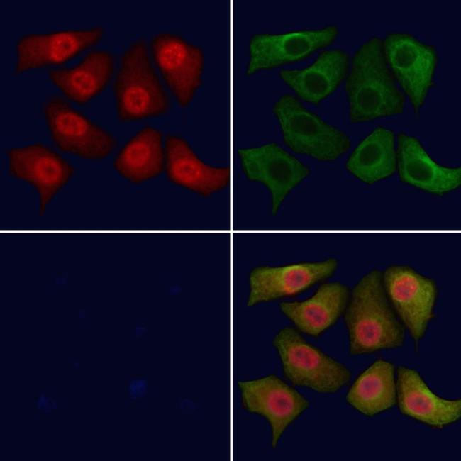 BRCA2 Antibody in Immunocytochemistry (ICC/IF)