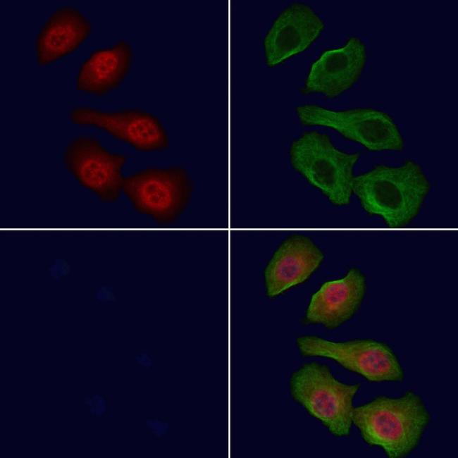 ACK1 Antibody in Immunocytochemistry (ICC/IF)