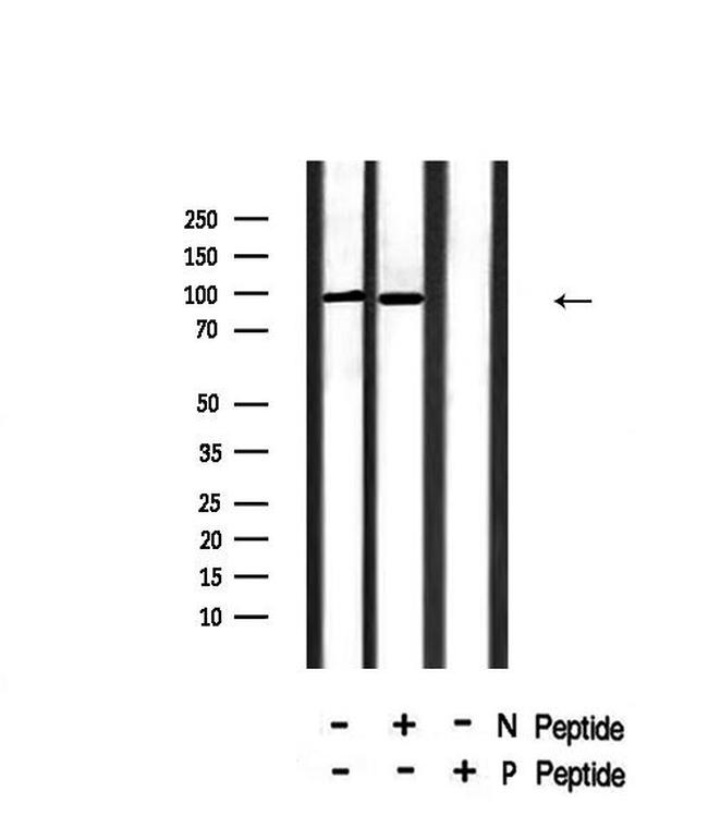 Phospho-INSR (Tyr999) Antibody in Western Blot (WB)