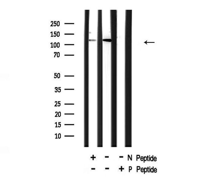 Phospho-NFkB p105 (Ser903) Antibody in Western Blot (WB)