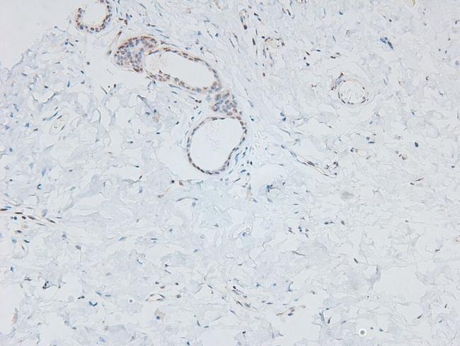 Phospho-PDGFRB (Tyr1009) Antibody in Immunohistochemistry (Paraffin) (IHC (P))