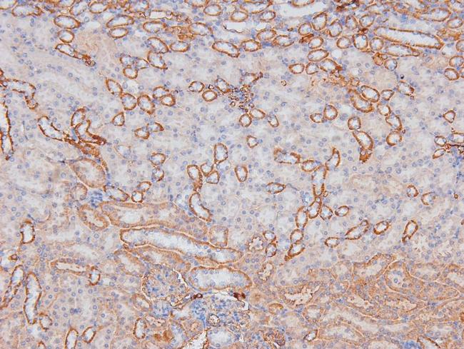 Phospho-RHOA (Ser188) Antibody in Immunohistochemistry (Paraffin) (IHC (P))