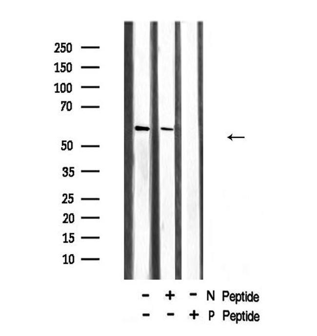 Phospho-Chk2 (Ser19) Antibody in Western Blot (WB)