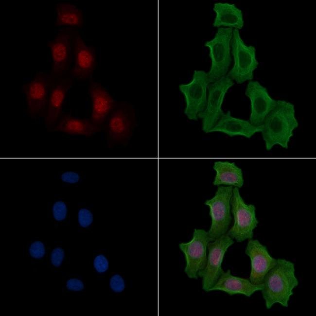 Phospho-TLK1 (Ser741) Antibody in Immunocytochemistry (ICC/IF)