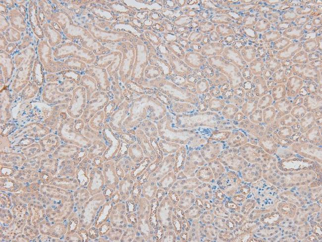 Phospho-Histone H2B (Ser15) Antibody in Immunohistochemistry (Paraffin) (IHC (P))