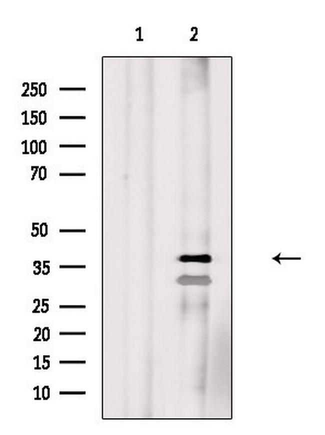 Phospho-C/EBP alpha (Ser190) Antibody in Western Blot (WB)