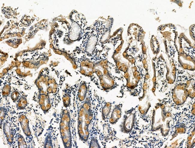 Phospho-GP130 (Ser782) Antibody in Immunohistochemistry (Paraffin) (IHC (P))